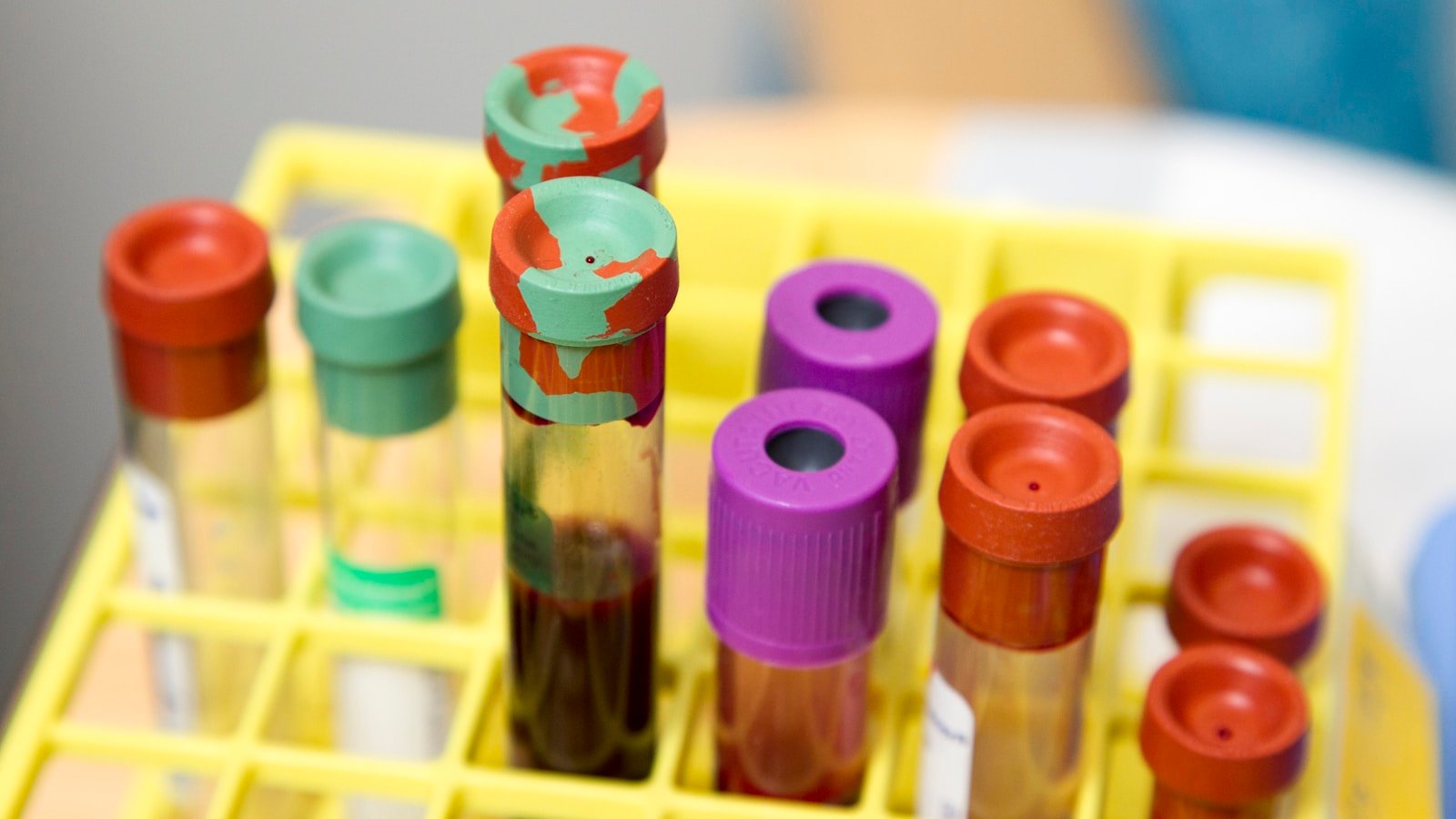Clear glass blood test tubes in a laboratory setting