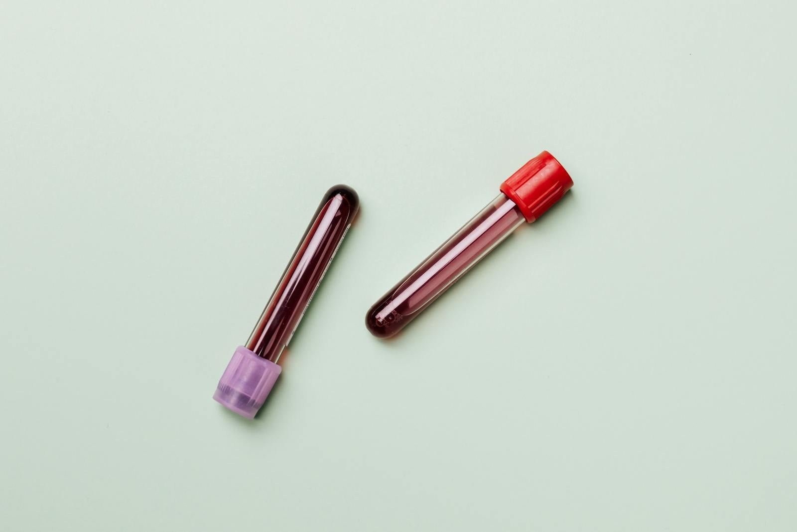 Blood sample tubes prepared for laboratory testing