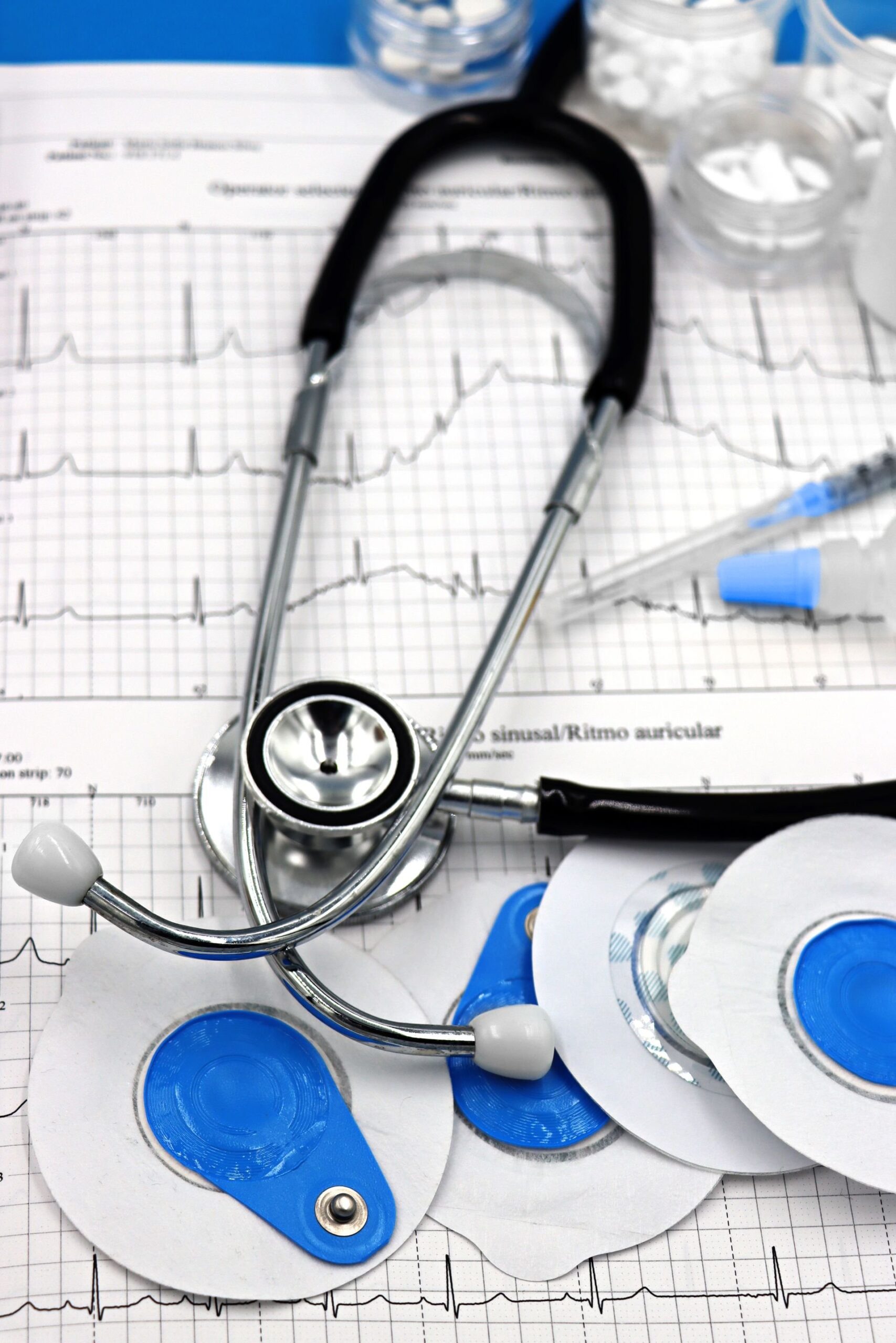 Stethoscope and ECG electrodes resting on a medical report