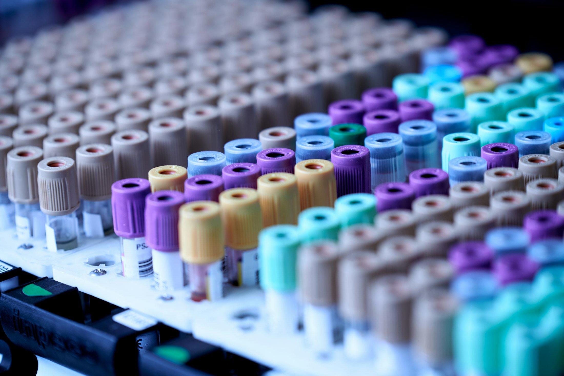 Rows of colour-coded blood test tubes in a laboratory rack