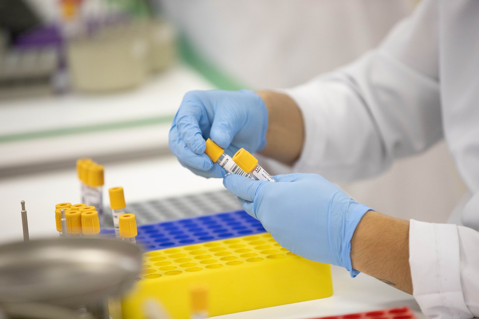 Laboratory blood testing equipment used to process clinical samples