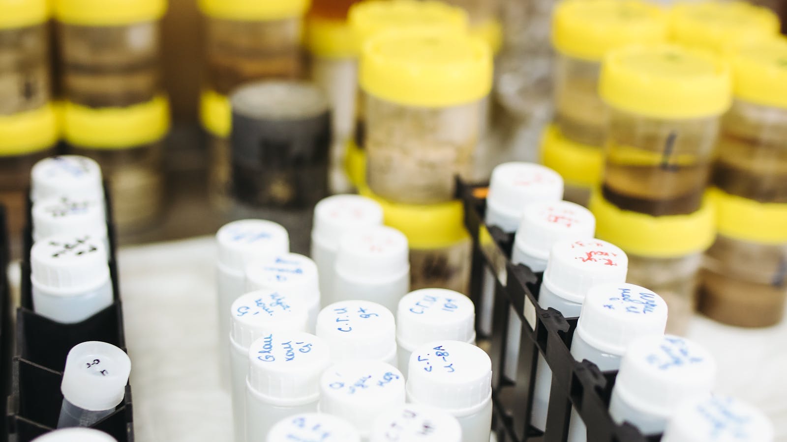 Laboratory test tubes and labelled sample containers used for clinical biomarker testing