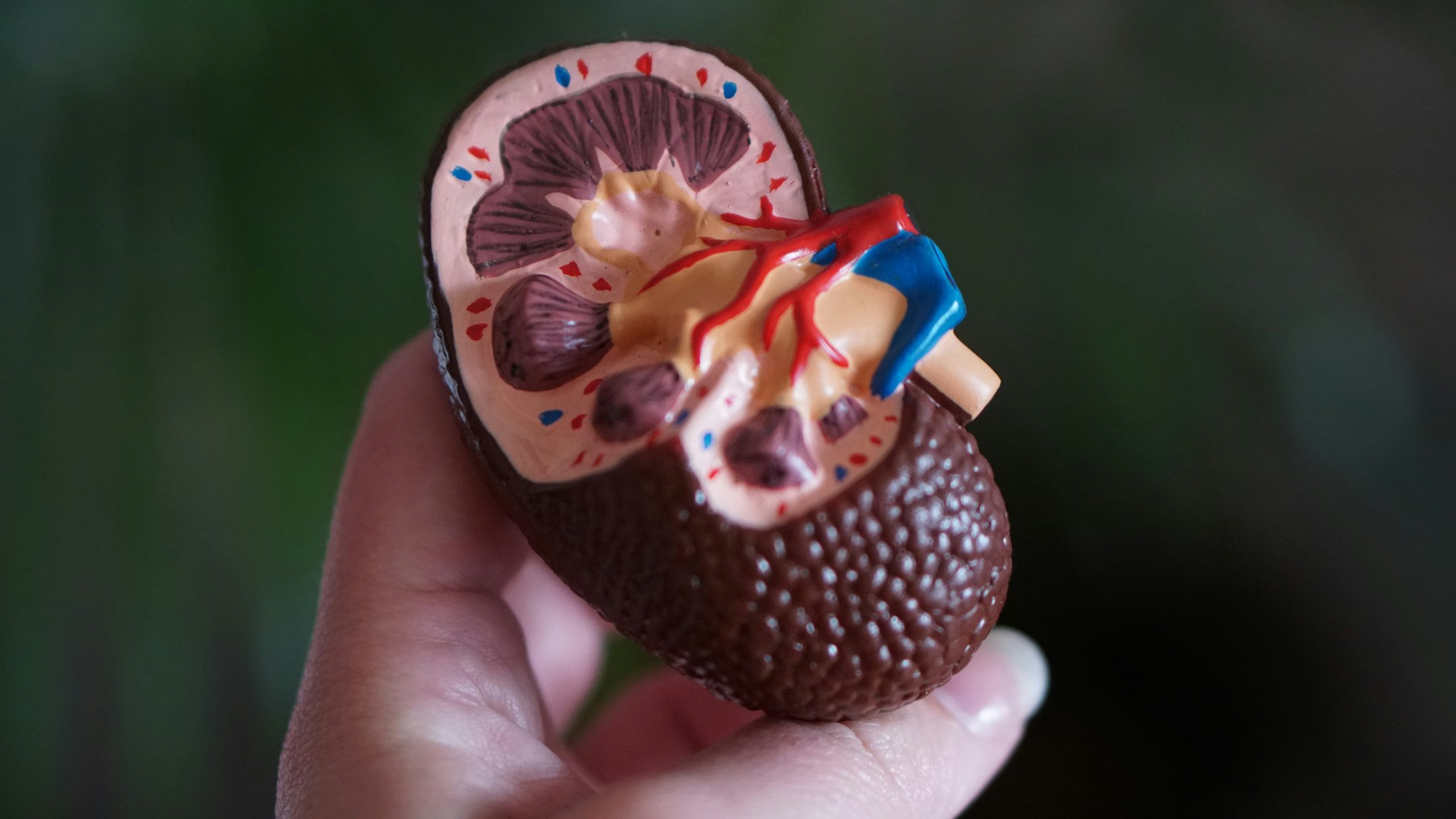 Anatomical kidney model used to illustrate cystatin C kidney testing