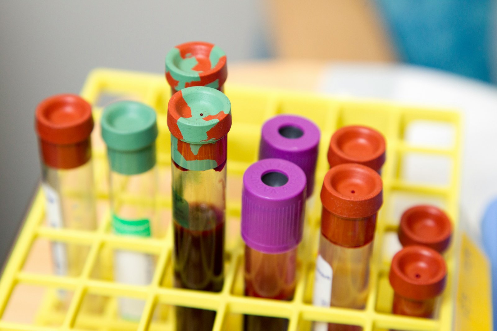 Clear laboratory test tubes prepared for biomarker testing