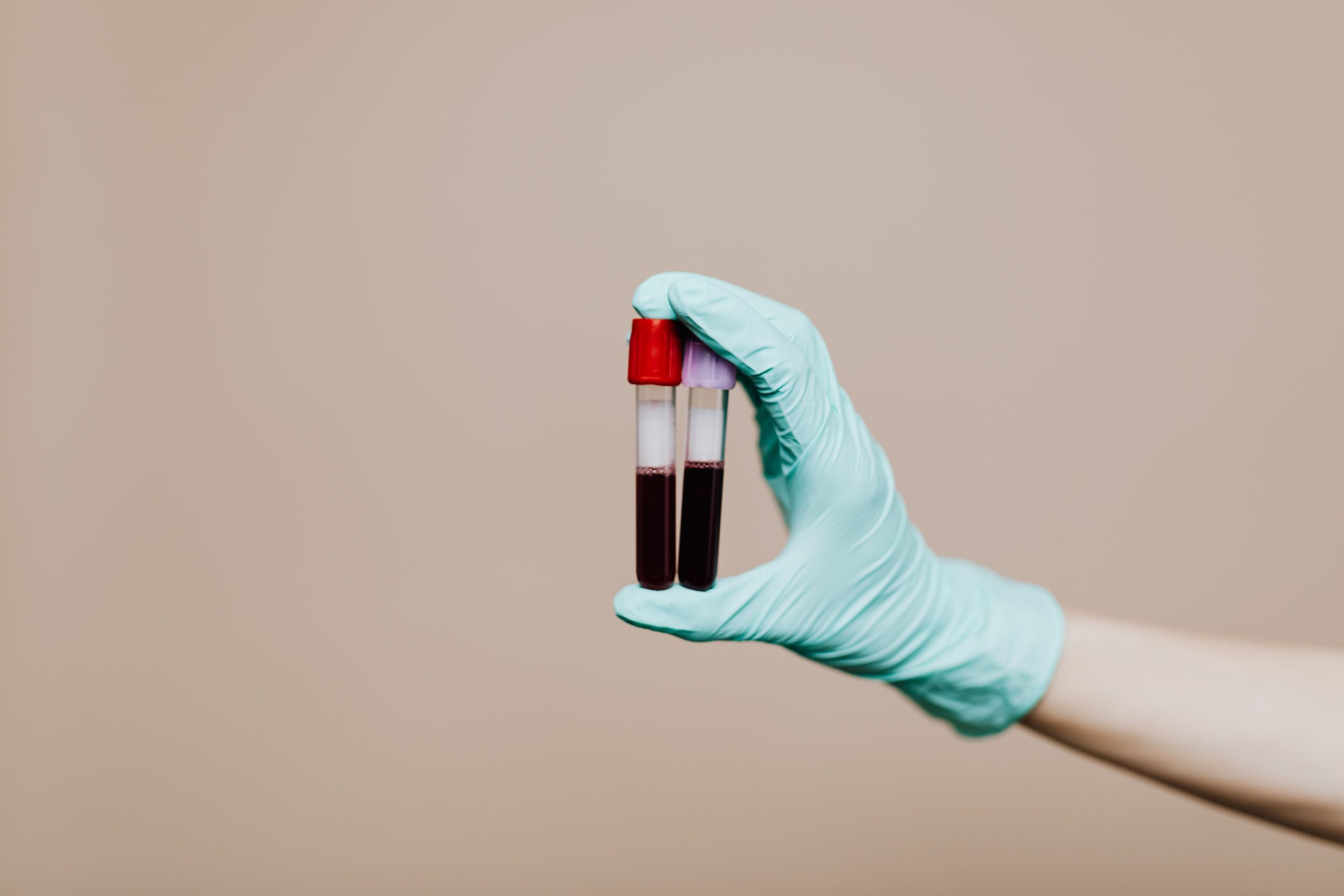 Laboratory test tubes used to illustrate cortisol testing.