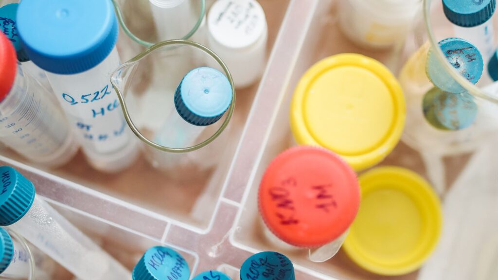 Laboratory sample containers with coloured caps viewed from above