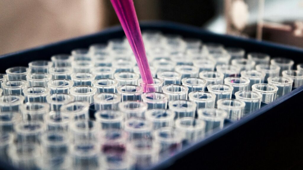 Laboratory equipment illustrating an article about PSA testing